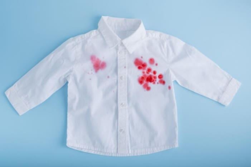 Manchas de sangre: cómo quitarlas de la ropa